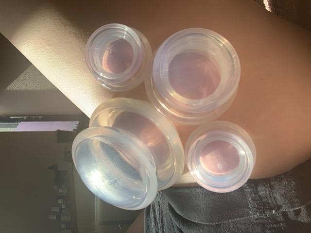 ELERA Silicone Cupping Therapy Set, Professionally Chinese Massage Cups for Cupping Therapy and Cellulite Reduction (7 Cups) customer photo 1