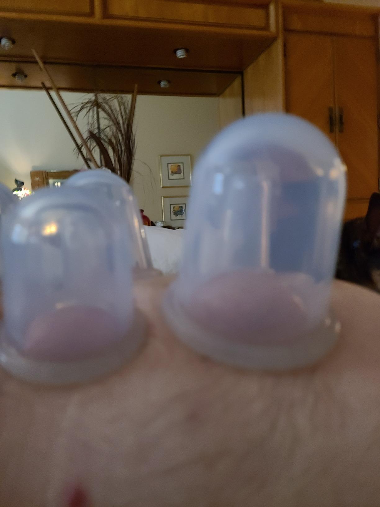 Silicone Facial Cupping Set, 4 Cups, Konjac Sponge, Face & Body customer photo 2