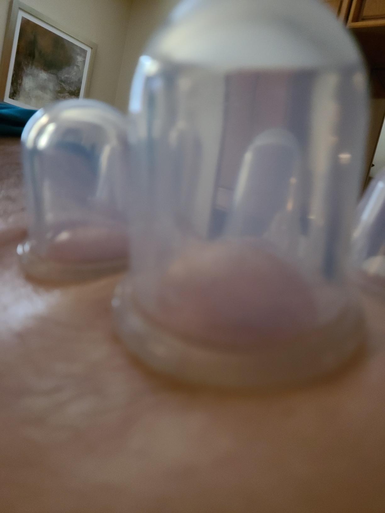 Silicone Cupping Set, 6 Massage Cups, 2 Sizes, for Pain Relief customer photo 1